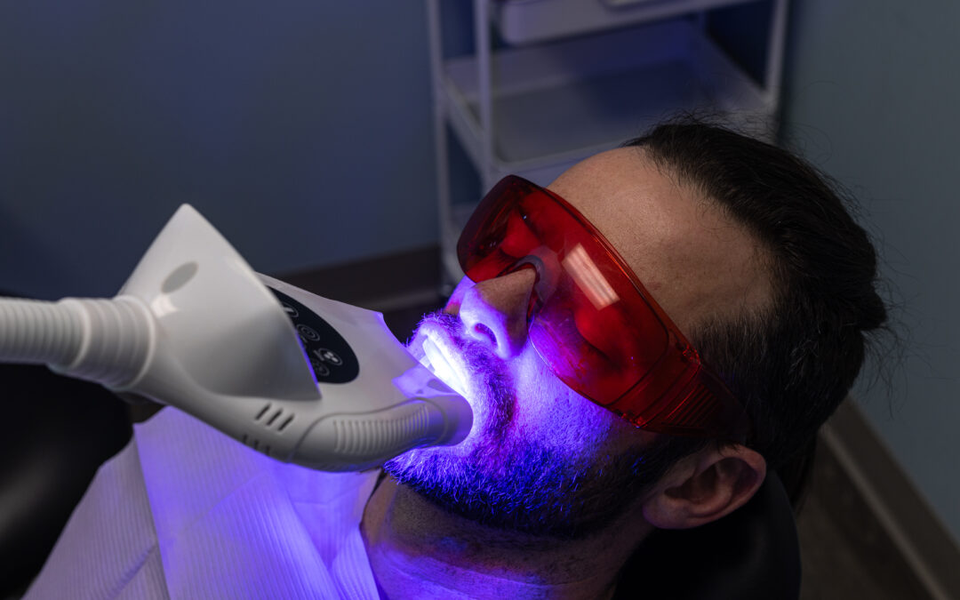 5 Quick Tips for Maintaining Your Whitening Results Between Visits